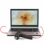 фото Компьютерный дерматоскоп РДС-3